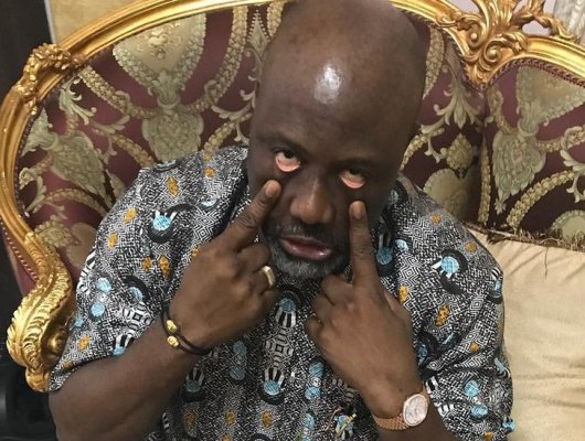PDP Suspends Dino Melaye